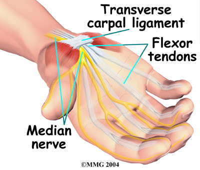 Carpal Tunnel